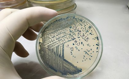 A dish of cultured bacteria. Image: Adobe. a gloved hand holds a clear dish which contains many blue dots